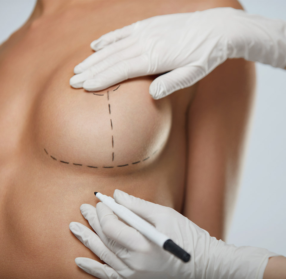 Best aesthetic breast surgeon in Belgium