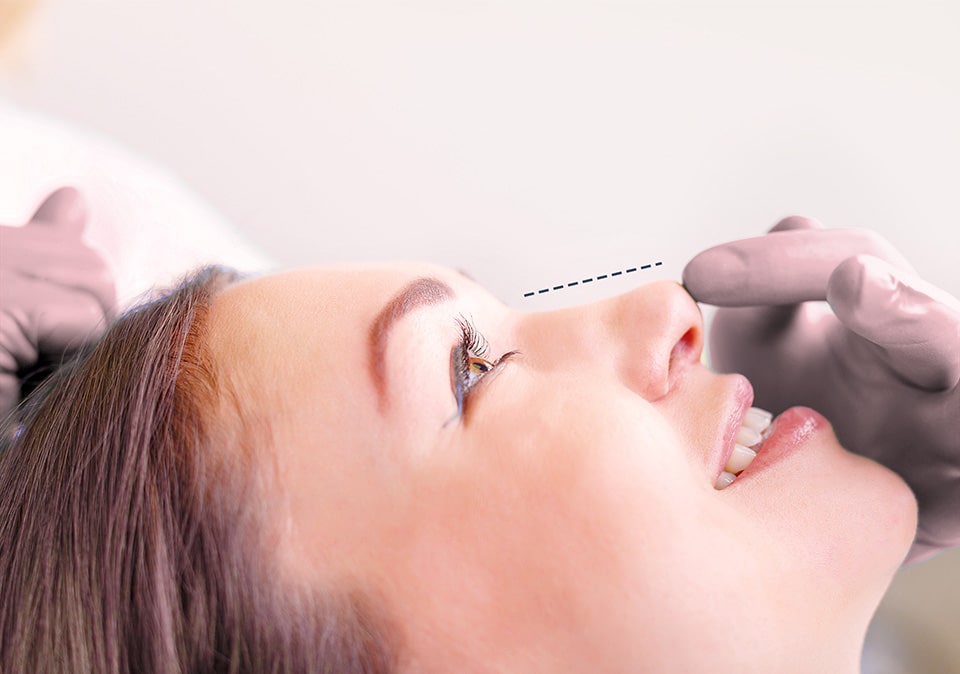 Best facial plastic surgeon in Belgium​